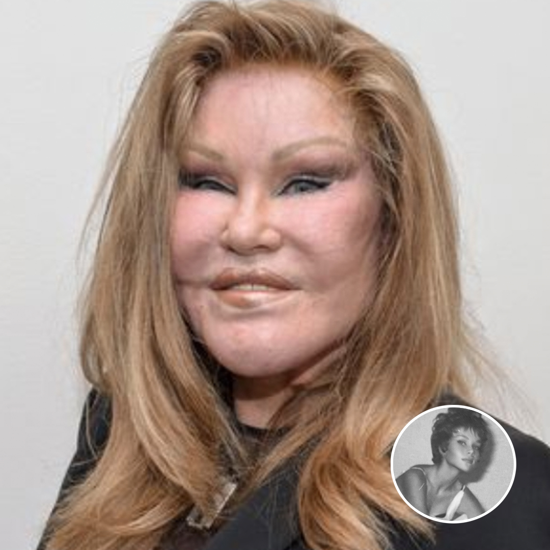 Jocelyn Wildenstein posts unrecognizable throwback photo as she hits out at plastic surgery rumors