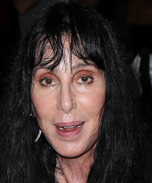 Our thoughts and prayers are with Cher after she received the ...
