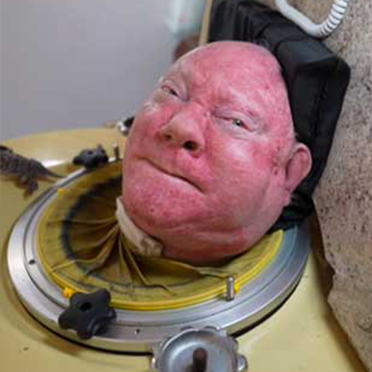 76-year-old man, paralyzed from polio at 6, is one of the last people with an iron lung: ‘My life is incredible’