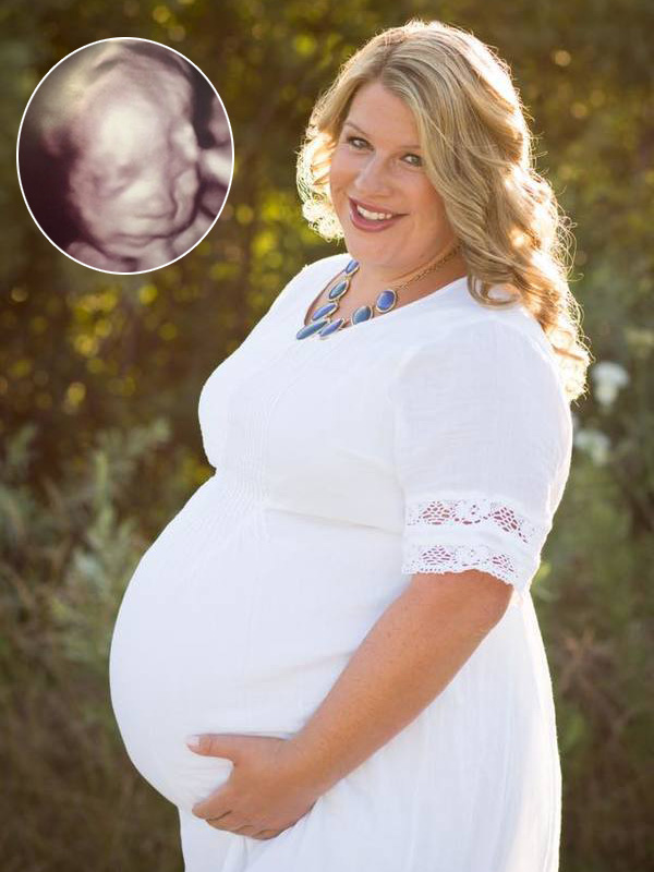 After her husband dies, she finds out she’s pregnant – then she sees the jaw-dropping ultrasound