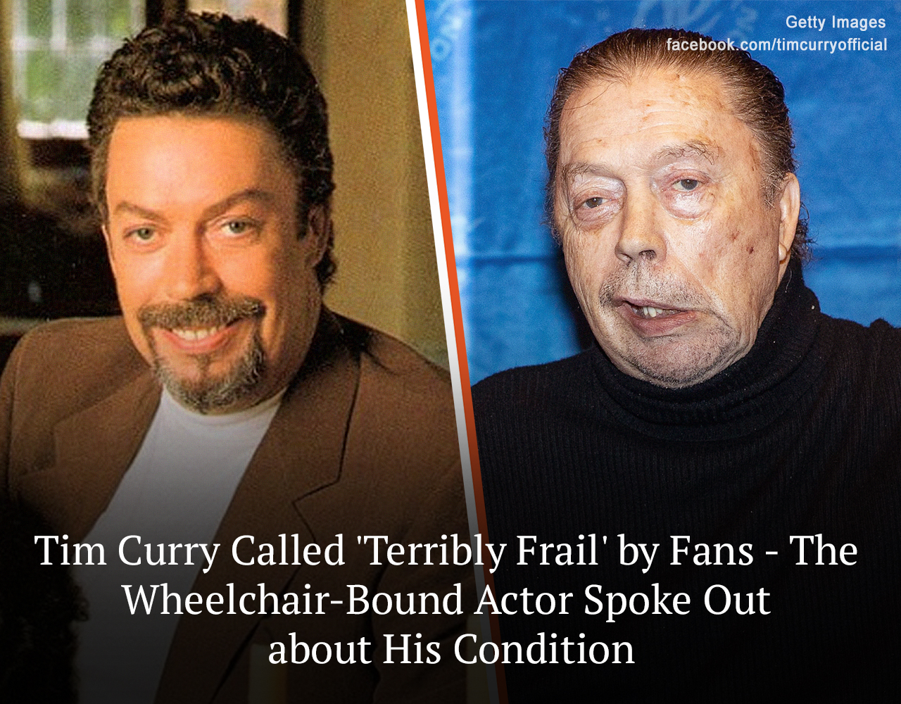 Tim Curry Called ‘Terribly Frail’ by Fans - Wheelchair-Bound Actor ...