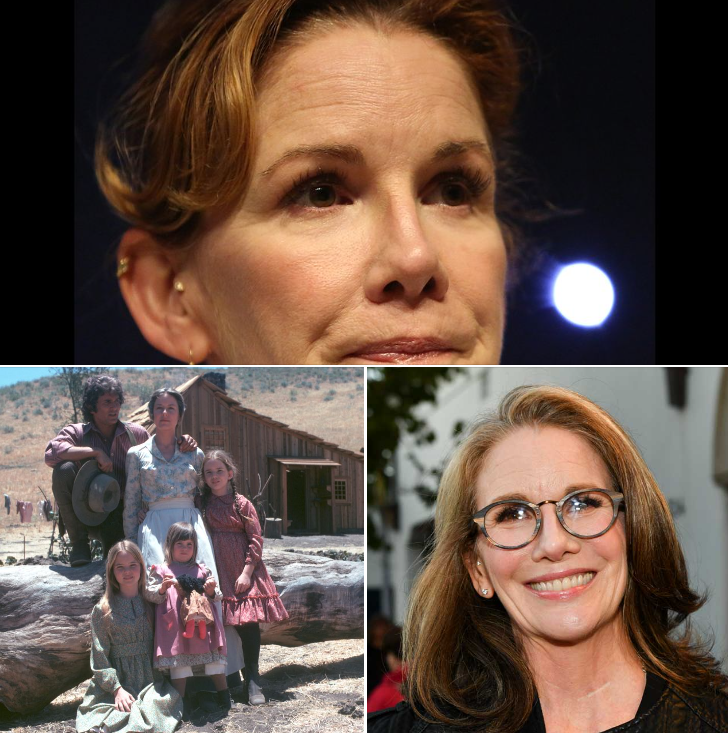 Melissa Gilbert embraces aging as she ditches Botox and implants