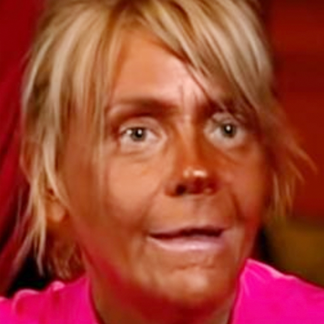 Patricia Krentcil tanned five days a week and almost lost her life – this is what “Tan Mom” looks like today