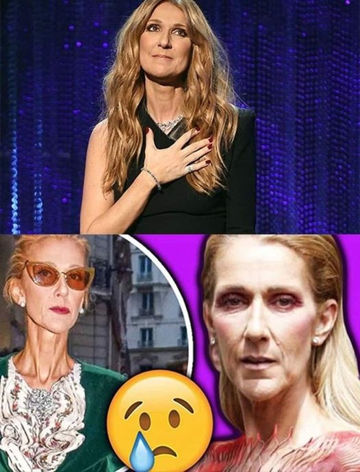 Celine Dion condition continues to deteriorate – she cancels her entire world tour