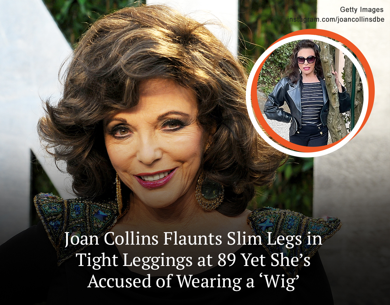 Joan Collins Blasted for Using ‘Fillers’ & ‘Wig’ — She Looks Stunning & Feels Happy with 32-Years-Younger Husband