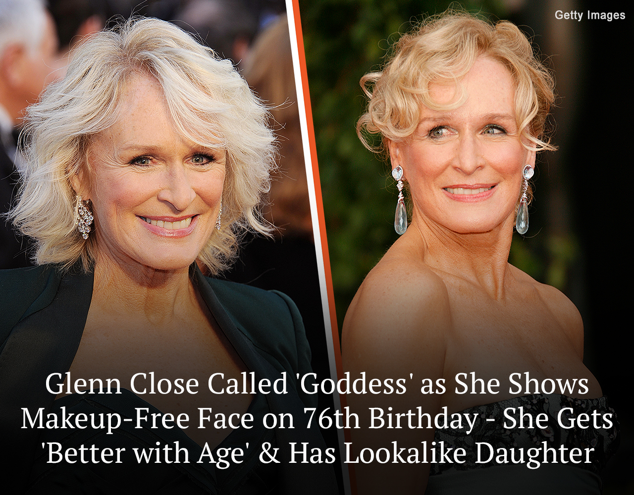 Legendary actress Glenn Close showed her makeup-free face on her 76th birthday and gave an update about her life and health.