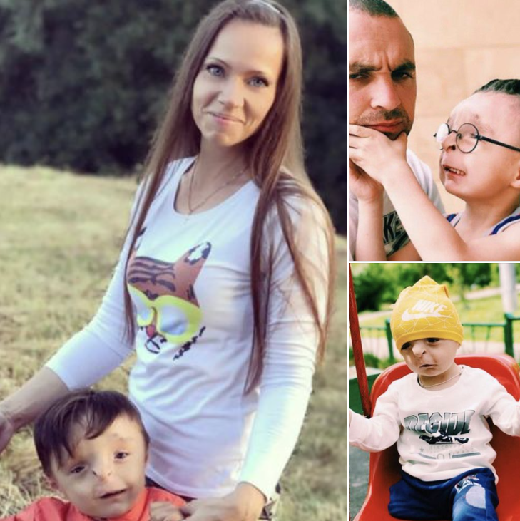 Couple adopt unwanted ‘freak’ boy who was abandoned at birth – see him now